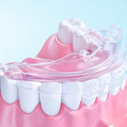 Pack de 3 Gouttières d'alignement dentaire