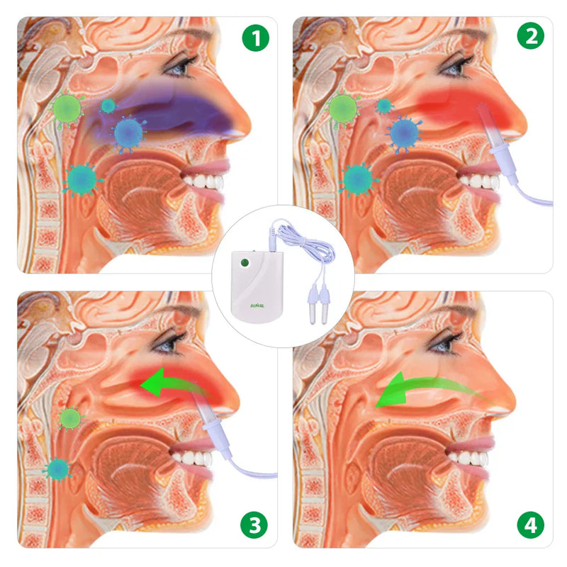 BIONASE - Dispositif de Thérapie Infrarouge Traitement Rhinite et Nez qui coule