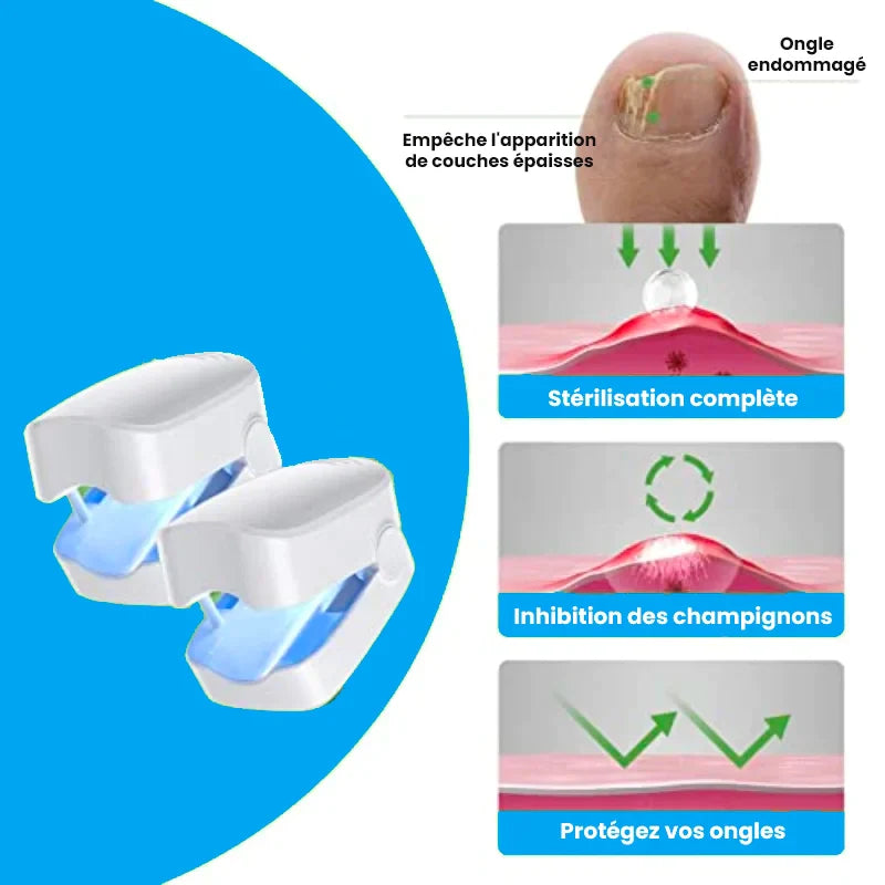 Appareil de traitement au laser pour champignon des ongles