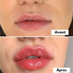 Sérum Magique pour des lèvres pulpeuses - Soins repulpant
